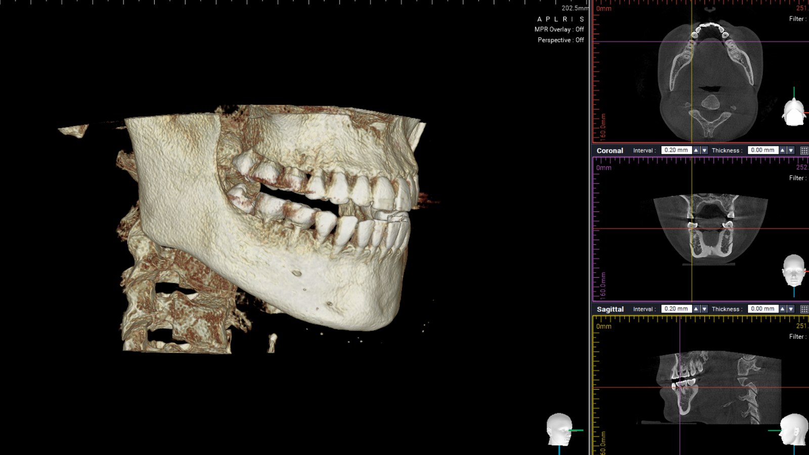 CT 3D 영상과 단면 · 원내 자료