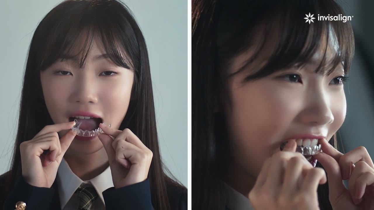 투명장치를 끼우는 장면 (인비절라인 공식 광고)